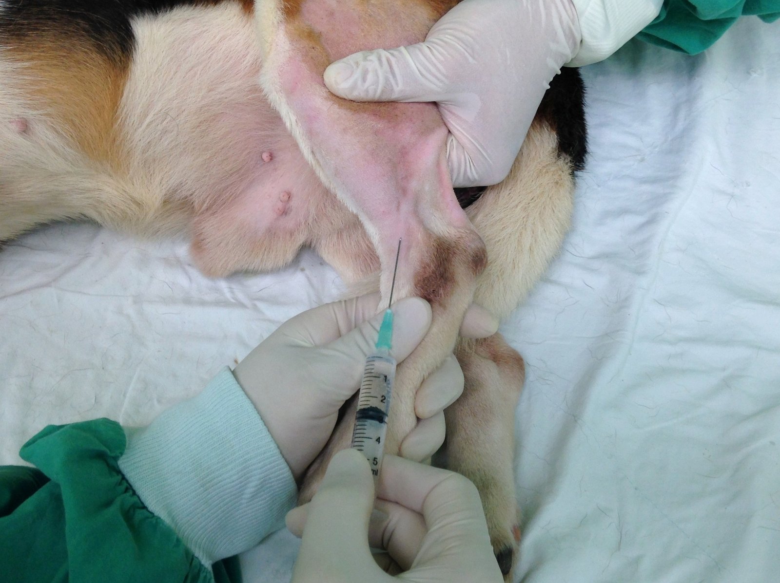 Saphenous vein (2)